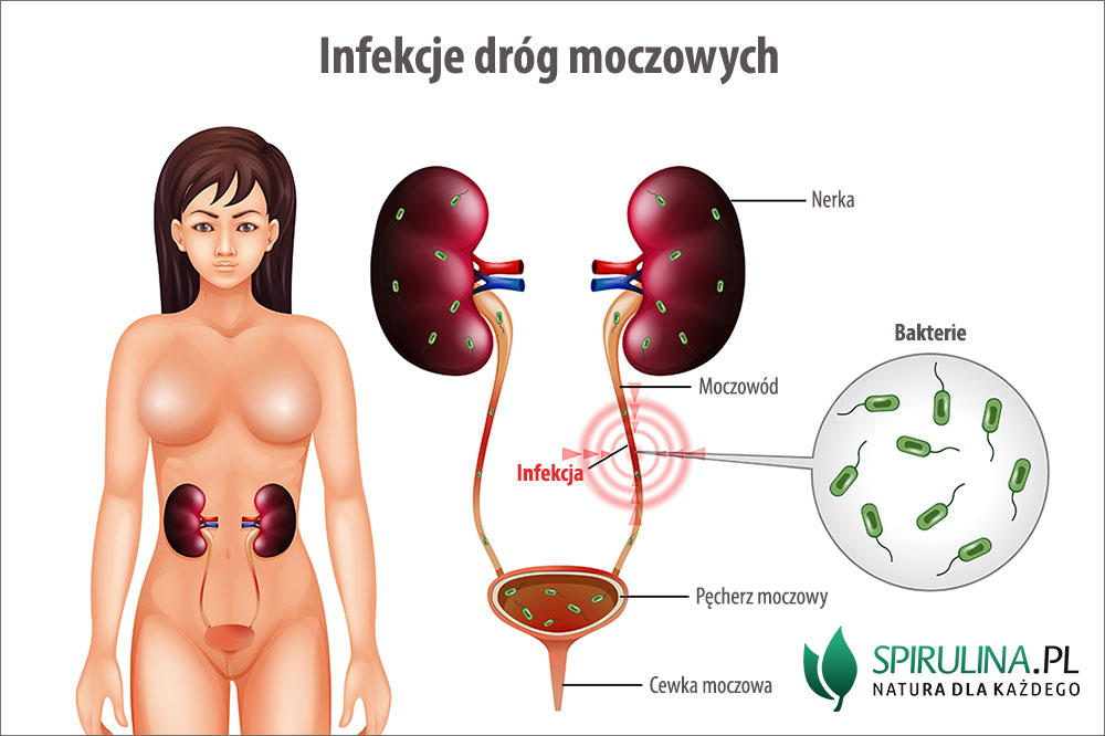 dabrowa górnicza pieluchy seni nfz