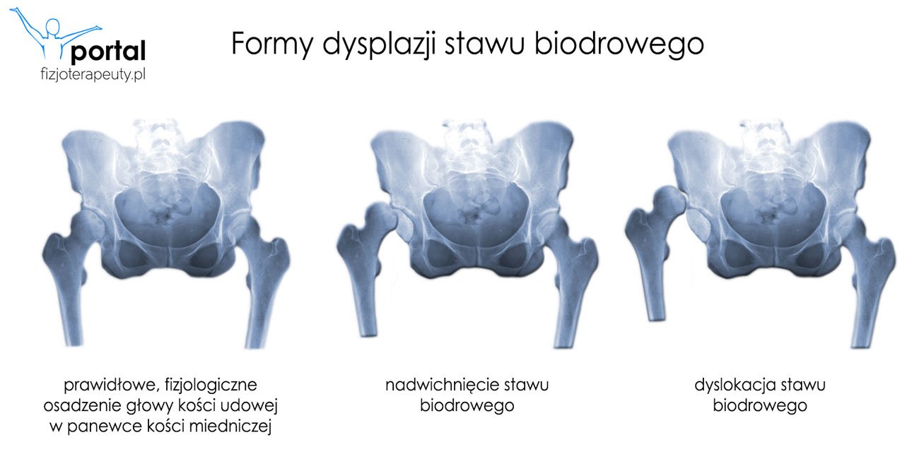 Japońskie pieluchomajtki Moony Natural PM 5-10kg próbka 3szt