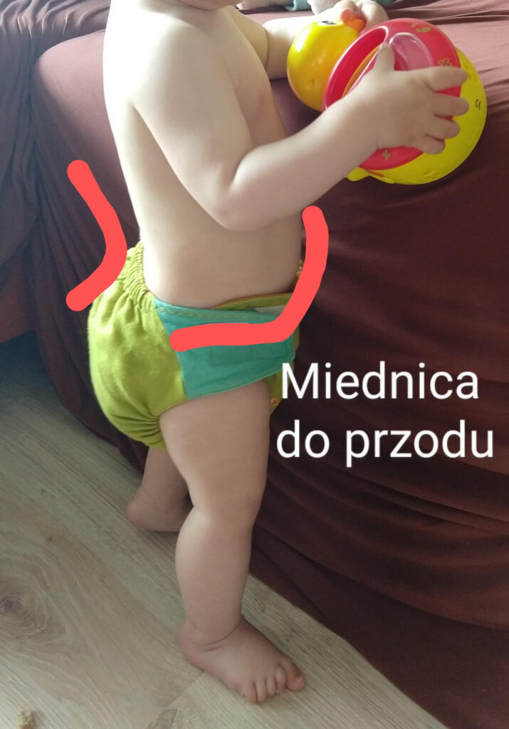 pampers odciska sie na pupie